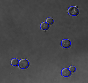 Outlined DIC microscopy yeast cells